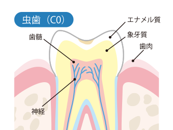 CO（シーオー） 初期