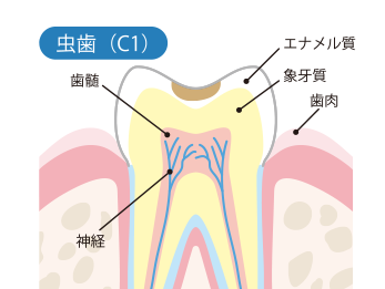 C1（シーワン）中期