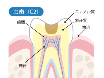 C2（シーツー）後期前半