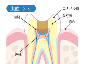 C3（シースリー）後期後半